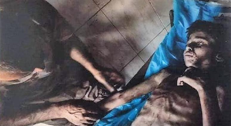 A small boy in Mosul. He came severely dehydrated and malnourished.