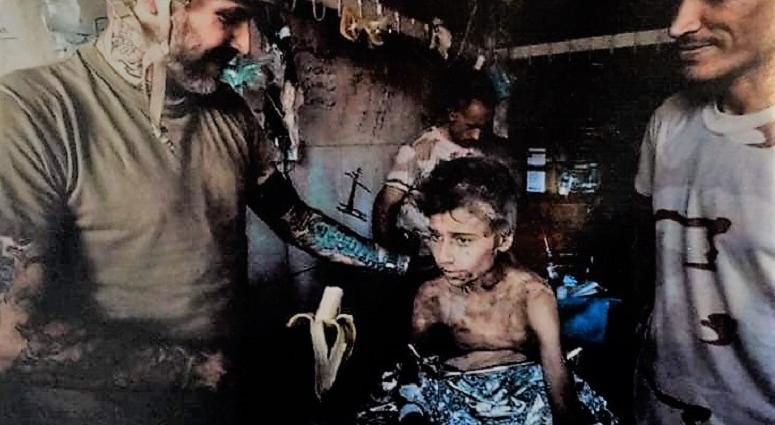 A small boy in Mosul. He came severely dehydrated and malnourished.