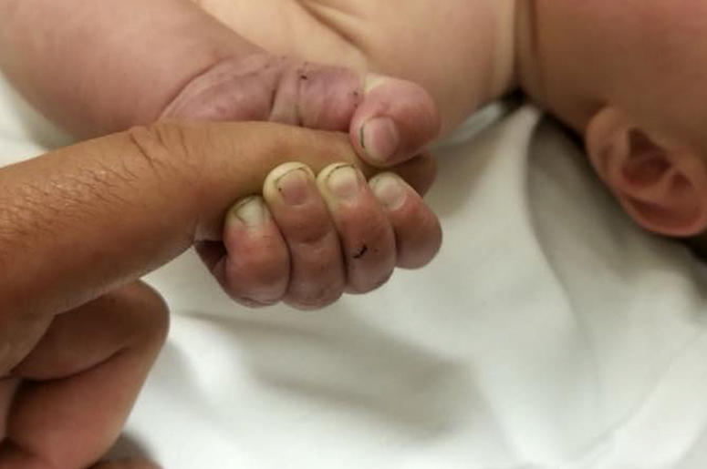 AP18190628230215 This Sunday, July 8, 2018 photo provided by the Missoula County Sheriff's Office shows a 5-month-old infant with dirt under their fingernails after authorities say the baby survived about nine hours being buried under sticks and debris in the woods. The M