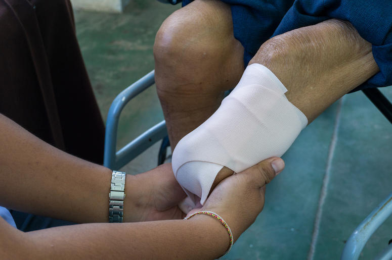 Elastic Bandages, Amputed Leg Elastic Bandages, Amputed Leg
