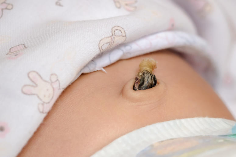 Baby, Stomach, Infant, Newborn, Umbilical Cord Baby, Stomach, Infant, Newborn, Umbilical Cord