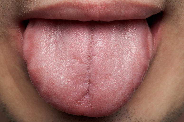 Man, Tongue Man, Tongue