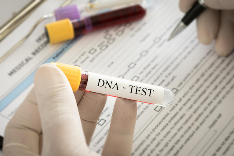 DNA Test, Genetics, Forensic Science, Scientist, Doctor, Gloves DNA Test, Genetics, Forensic Science, Scientist, Doctor, Gloves