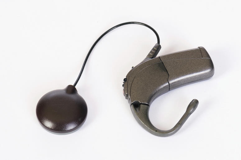 Cochlear Implant cochlear_implant