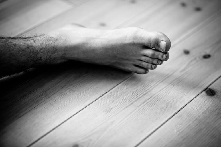 amputated foot amputated foot