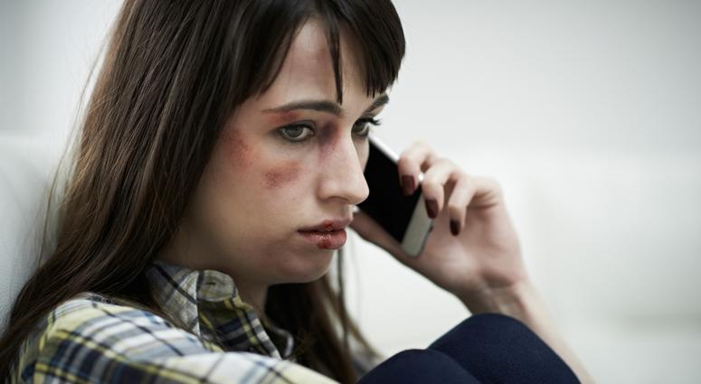 A woman with bruises on her face holds a cell phone near her ear