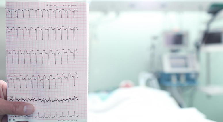 heart attack ECG with a heart attack in hospital ward