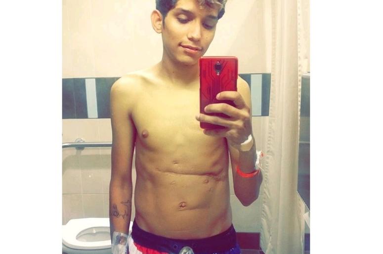 Joven Del Metroplex Necesita Un Trasplante de Hígado Ricardo Mendoza Jr De 23 Años Necesita Un Trasplante De Hígado Si No Morirá En 3 Años