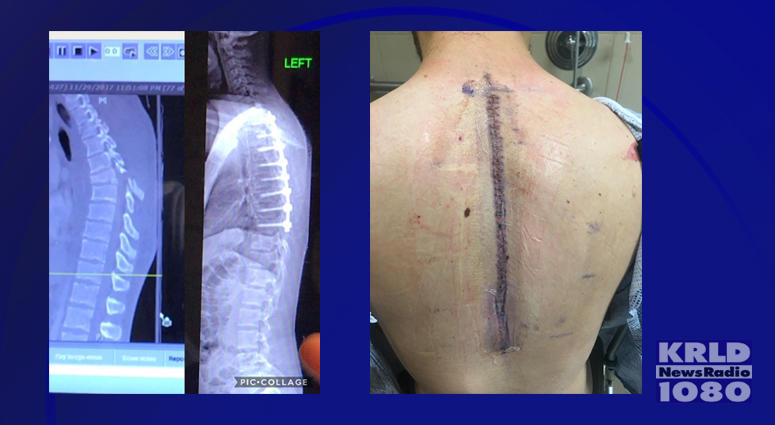 Braiden Williams Surgery Braiden Williams Surgery