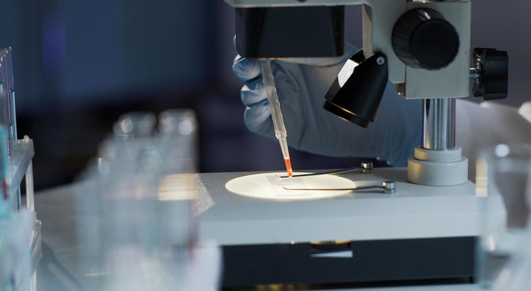 HIV infection test, analysis HIV infection test, analysis