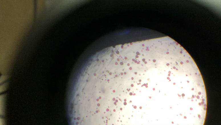 Pollen is seen through a microscope. Pollen is seen through a microscope.