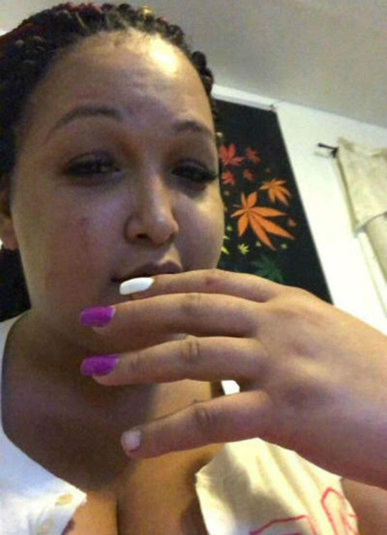 Sanchez says she's been attacked more than a dozen times - the worst was an attack with four-by-fours at age 18. Her most recent attack took place last year and left her with a bruised face. Sanchez says she's been attacked more than a dozen times - the worst was an attack with four-by-fours at age 18. Her most recent attack took place last year and left her with a bruised face.