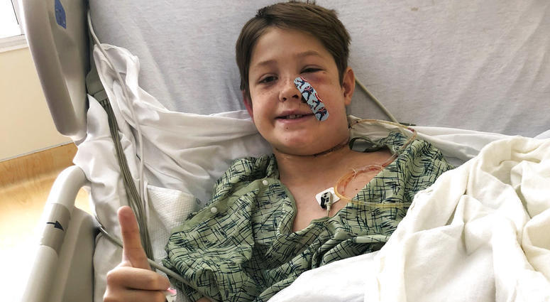 Xavier Cunningham, of Harrisonville, Mo., gives a thumbs up while recovering at the University of Kansas Hospital after surgery to remove a meat skewer that penetrated his skull from his face to the back of his head. Xavier Cunningham, of Harrisonville, Mo., gives a thumbs up while recovering at the University of Kansas Hospital after surgery to remove a meat skewer that penetrated his skull from his face to the back of his head.
