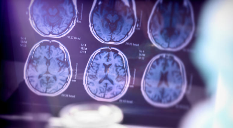 Brain scan.