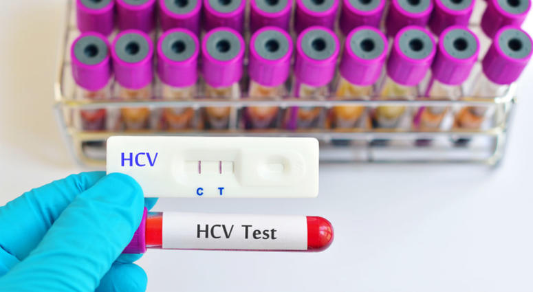 Hepatitis C testing Hepatitis C testing