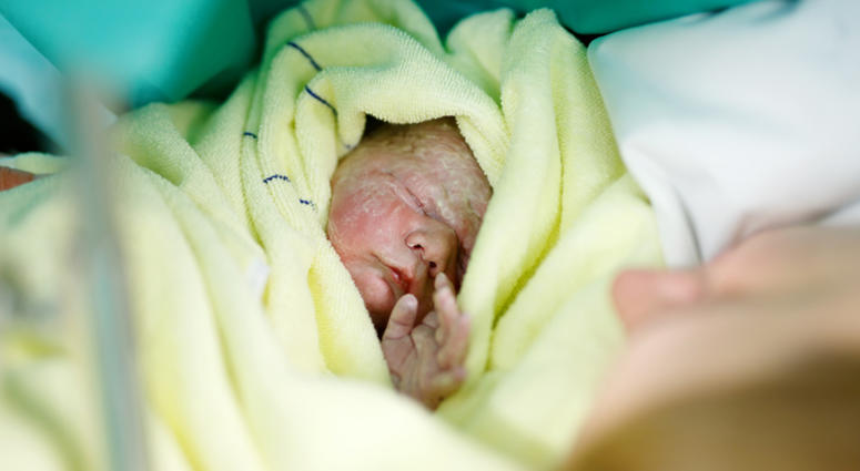 Newborn baby being born via Caesarean Section. Child Birth