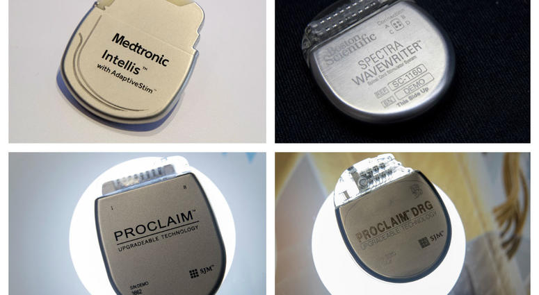 This combination of Aug. 25, 2018 photos shows demonstration models of implantable neurostimulators, top row from left, the Medtronic Intellis and the Boston Scientific Spectra WaveWriter SCS. This combination of Aug. 25, 2018 photos shows demonstration models of implantable neurostimulators, top row from left, the Medtronic Intellis and the Boston Scientific Spectra WaveWriter SCS.