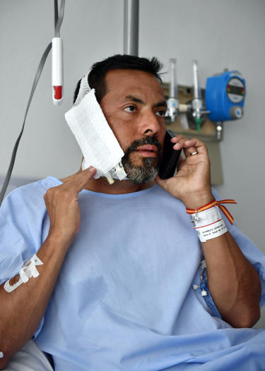 AP19189621139317 REMOVES WEIGHT OF BULL - Jaime Alvarez from Santa Clara County, California, sits in a hospital in Pamplona, northern Spain, Monday, July 8, 2019 after being gored by a bull Sunday at the San Fermin Festival. (AP Photo/Alvaro Barrientos)