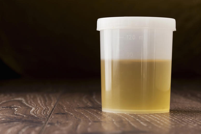 Jar of urine Jar of urine