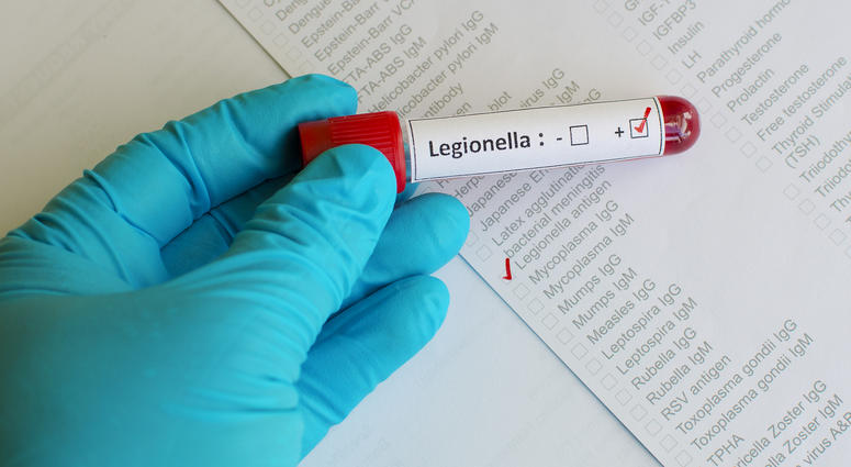 Blood sample with legionella positive Legionnaires’ Disease