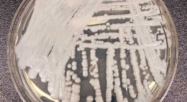 Candida Auris Candida Auris