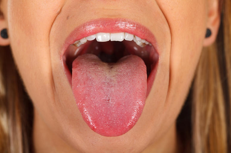 Tongue Tongue