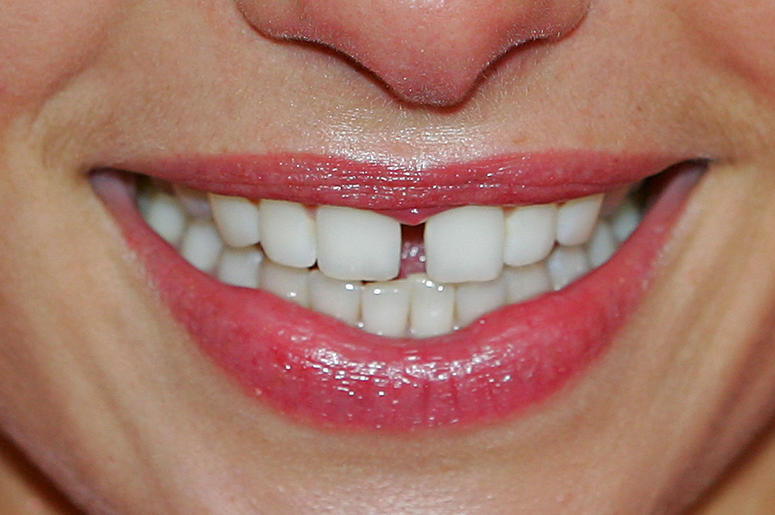 Teeth Teeth