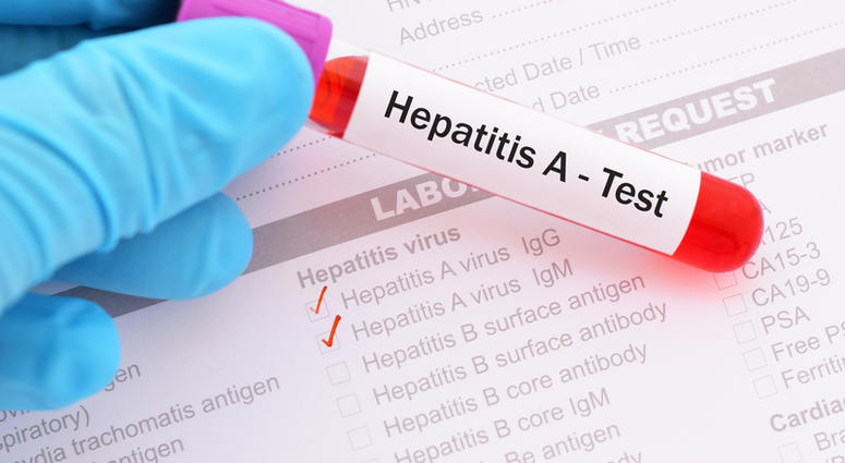 Hepatitis A Hepatitis A