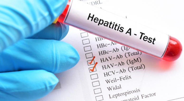hepatitis A hepatitis A
