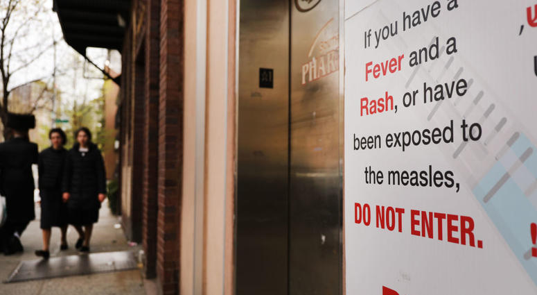 measles sign measles sign