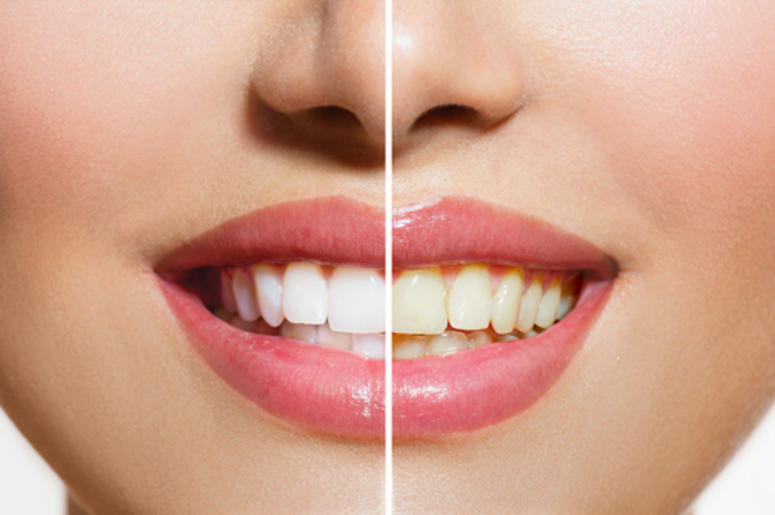 teeth teeth