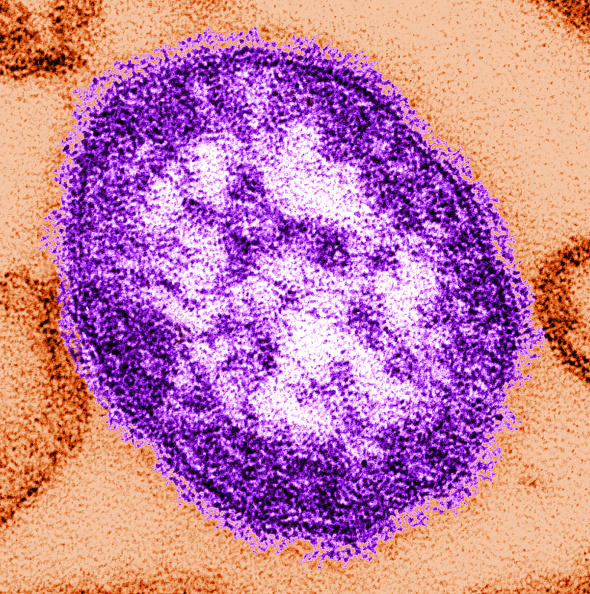 A thin-section transmission electron micrograph (TEM) reveales the ultrastructural appearance of a single virus particle, or "virion", of measles virus. Close up if the measles virus